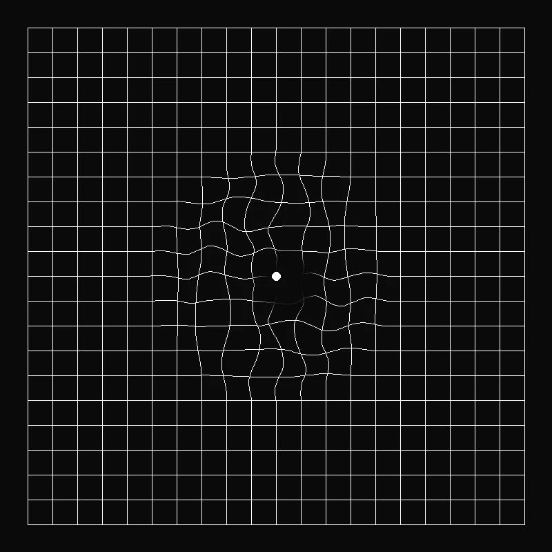 Distorted view (possible AMD sign)